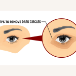 Remove Dark Circles