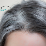 White Hair Problem