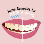 Teeth Whitening